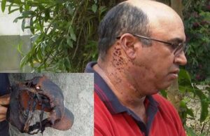 Homem atingido por raio na cabeça sobrevive e quer levar boné queimado em acidente até o Santuário de Aparecida